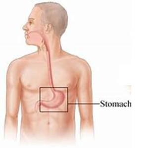 Hiatal stomach