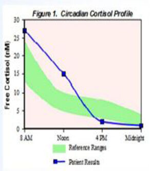 adrenal stress index test cortisol high and then low out put